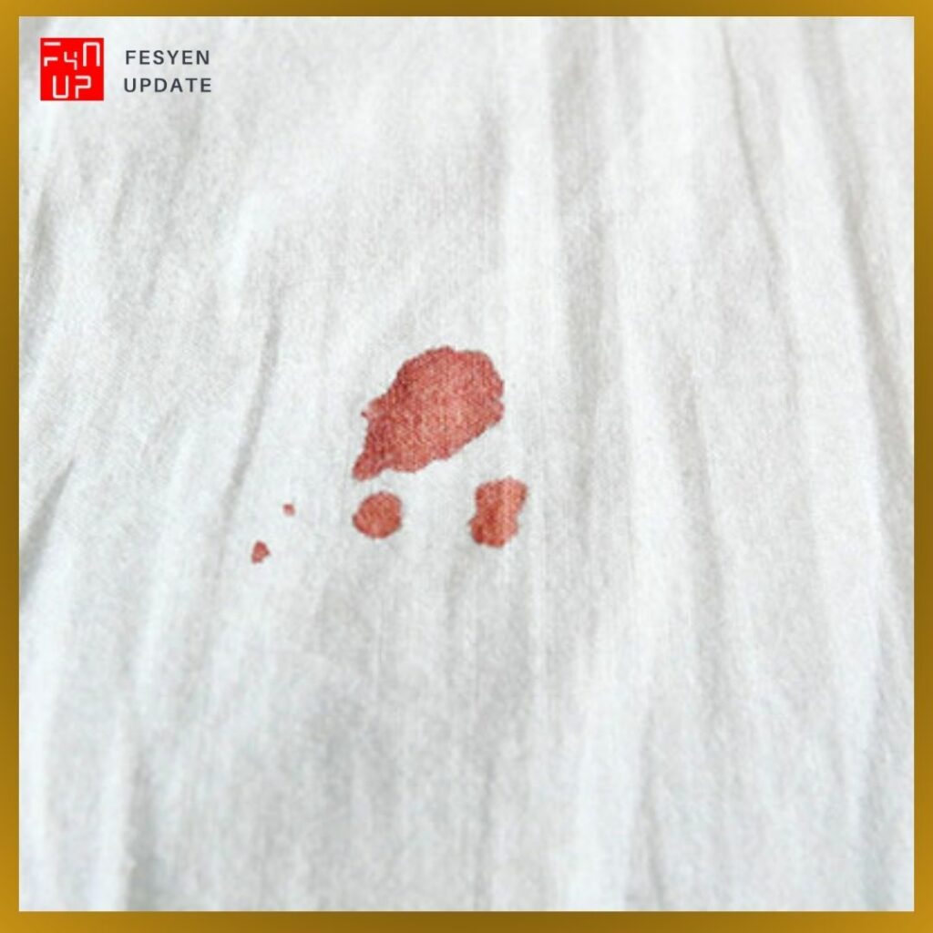 Imej Cara Hilangkan Kotoran Degil pada Baju dari Tompokan Darah